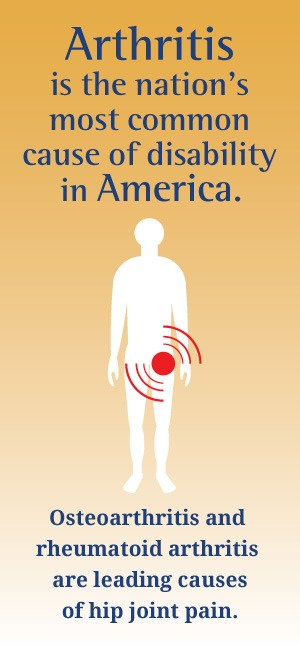 Arthritis is the nation's most common cause of disability in America.